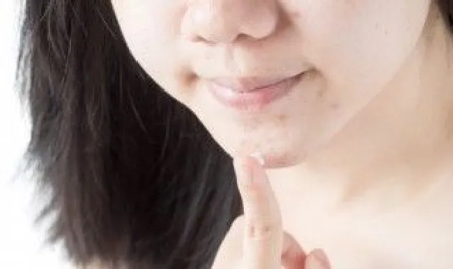 额头长痘去除的方法（额头长痘去除的方法是什么）