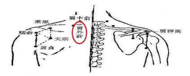 肩外俞在哪里（肩外俞在什么位置）